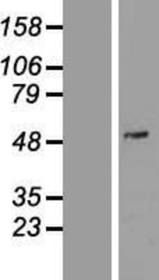 Western Blot: PDE7A Overexpression Lysate (Adult Normal) [NBP2-08091] Left-Empty vector transfected control cell lysate (HEK293 cell lysate); Right -Over-expression Lysate for PDE7A.