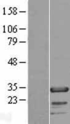 Western Blot: FHL2 Overexpression Lysate (Adult Normal) [NBP2-08208] Left-Empty vector transfected control cell lysate (HEK293 cell lysate); Right -Over-expression Lysate for FHL2.
