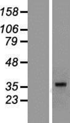 Western Blot: MR1 Overexpression Lysate (Adult Normal) [NBP2-08196] Left-Empty vector transfected control cell lysate (HEK293 cell lysate); Right -Over-expression Lysate for MR1.