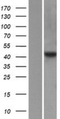 Western Blot: FNTA Overexpression Lysate (Adult Normal) [NBP2-08153] Left-Empty vector transfected control cell lysate (HEK293 cell lysate); Right -Over-expression Lysate for FNTA.