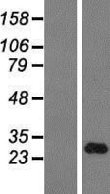 Western Blot: IFNA14 Overexpression Lysate (Adult Normal) [NBP2-08142] Left-Empty vector transfected control cell lysate (HEK293 cell lysate); Right -Over-expression Lysate for IFNA14.