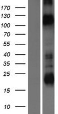 Western Blot: KCNH1 Overexpression Lysate (Adult Normal) [NBP2-08137] Left-Empty vector transfected control cell lysate (HEK293 cell lysate); Right -Over-expression Lysate for KCNH1.