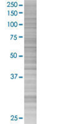 CSTB transfected lysate.