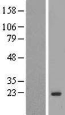 Western Blot: MAFG Overexpression Lysate (Adult Normal) [NBP2-08121] Left-Empty vector transfected control cell lysate (HEK293 cell lysate); Right -Over-expression Lysate for MAFG.