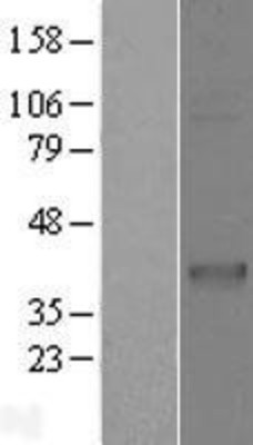 Western Blot: CD1c Overexpression Lysate (Adult Normal) [NBP2-08178] Left-Empty vector transfected control cell lysate (HEK293 cell lysate); Right -Over-expression Lysate for CD1c.