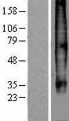 Western Blot: CCR7 Overexpression Lysate (Adult Normal) [NBP2-08171] Left-Empty vector transfected control cell lysate (HEK293 cell lysate); Right -Over-expression Lysate for CCR7.