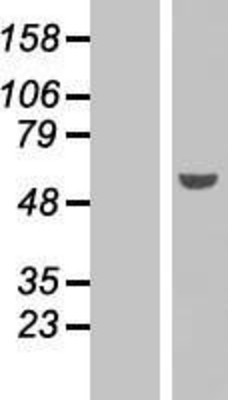 Western Blot: PAX6 Overexpression Lysate (Adult Normal) [NBP2-08189] Left-Empty vector transfected control cell lysate (HEK293 cell lysate); Right -Over-expression Lysate for PAX6.