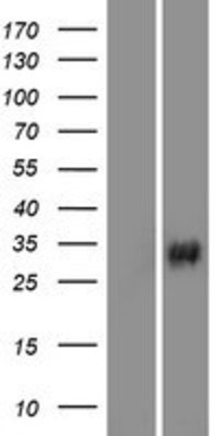 Western Blot: VAV3 Overexpression Lysate (Adult Normal) [NBP2-08481] Left-Empty vector transfected control cell lysate (HEK293 cell lysate); Right -Over-expression Lysate for VAV3.