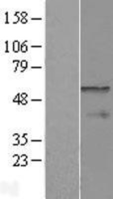 Western Blot: CPEB1 Overexpression Lysate (Adult Normal) [NBP2-08471] Left-Empty vector transfected control cell lysate (HEK293 cell lysate); Right -Over-expression Lysate for CPEB1.
