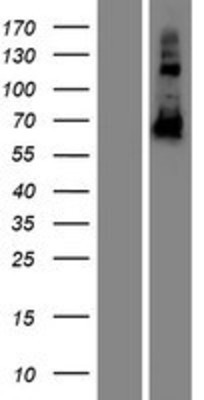 Western Blot: CCDC102B Overexpression Lysate (Adult Normal) [NBP2-08331] Left-Empty vector transfected control cell lysate (HEK293 cell lysate); Right -Over-expression Lysate for CCDC102B.