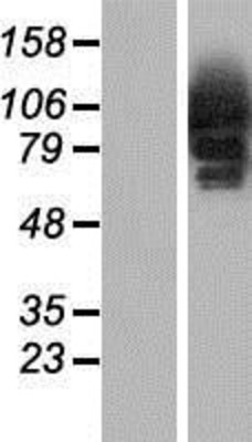 Western Blot: CYLD Overexpression Lysate (Adult Normal) [NBP2-08360] Left-Empty vector transfected control cell lysate (HEK293 cell lysate); Right -Over-expression Lysate for CYLD.