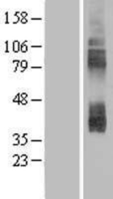 Western Blot: SLC7A3 Overexpression Lysate (Adult Normal) [NBP2-08343] Left-Empty vector transfected control cell lysate (HEK293 cell lysate); Right -Over-expression Lysate for SLC7A3.