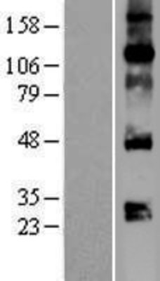 Western Blot: VEGFA Overexpression Lysate (Adult Normal) [NBP2-08633] Left-Empty vector transfected control cell lysate (HEK293 cell lysate); Right -Over-expression Lysate for VEGFA.