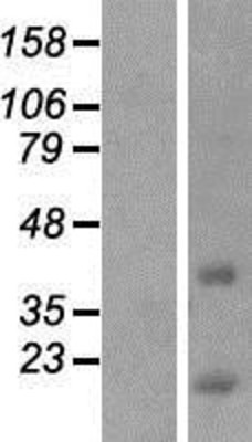 Western Blot: CCDC153 Overexpression Lysate (Adult Normal) [NBP2-08626] Left-Empty vector transfected control cell lysate (HEK293 cell lysate); Right -Over-expression Lysate for CCDC153.