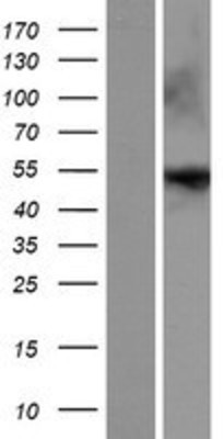 Western Blot: ENTPD8 Overexpression Lysate (Adult Normal) [NBP2-08622] Left-Empty vector transfected control cell lysate (HEK293 cell lysate); Right -Over-expression Lysate for ENTPD8.