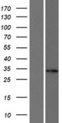Western Blot: FANCA Overexpression Lysate (Adult Normal) [NBP2-08666] Left-Empty vector transfected control cell lysate (HEK293 cell lysate); Right -Over-expression Lysate for FANCA.