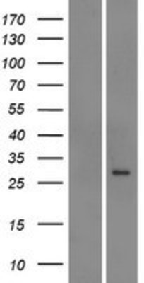 Western Blot: ABCC5 Overexpression Lysate (Adult Normal) [NBP2-08652] Left-Empty vector transfected control cell lysate (HEK293 cell lysate); Right -Over-expression Lysate for ABCC5.