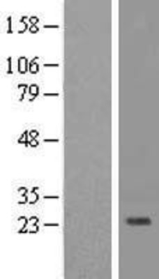 Western Blot: IL32 Overexpression Lysate (Adult Normal) [NBP2-08698] Left-Empty vector transfected control cell lysate (HEK293 cell lysate); Right -Over-expression Lysate for IL32.