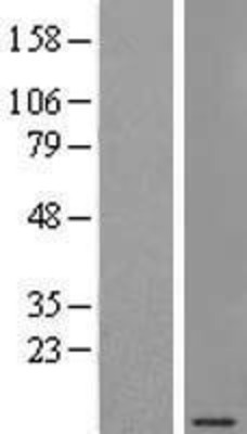 Western Blot: SEC61G Overexpression Lysate (Adult Normal) [NBP2-08695] Left-Empty vector transfected control cell lysate (HEK293 cell lysate); Right -Over-expression Lysate for SEC61G.