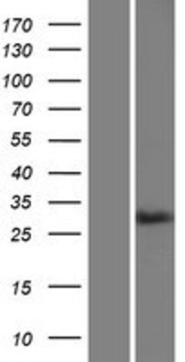 Western Blot: MAdCAM1 Overexpression Lysate (Adult Normal) [NBP2-05730] Left-Empty vector transfected control cell lysate (HEK293 cell lysate); Right -Over-expression Lysate for MAdCAM1.