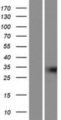 Western Blot: GIPC3 Overexpression Lysate (Adult Normal) [NBP2-05711] Left-Empty vector transfected control cell lysate (HEK293 cell lysate); Right -Over-expression Lysate for GIPC3.