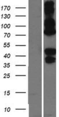 Western Blot: Asialoglycoprotein Receptor 2 Overexpression Lysate (Adult Normal) [NBP2-05750] Left-Empty vector transfected control cell lysate (HEK293 cell lysate); Right -Over-expression Lysate for Asialoglycoprotein Receptor 2.
