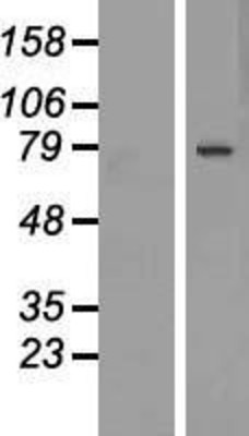 Western Blot: DACH1 Overexpression Lysate (Adult Normal) [NBP2-05764] Left-Empty vector transfected control cell lysate (HEK293 cell lysate); Right -Over-expression Lysate for DACH1.