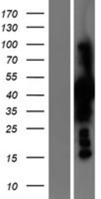 Western Blot: PSAT1 Overexpression Lysate (Adult Normal) [NBP2-05799] Left-Empty vector transfected control cell lysate (HEK293 cell lysate); Right -Over-expression Lysate for PSAT1.