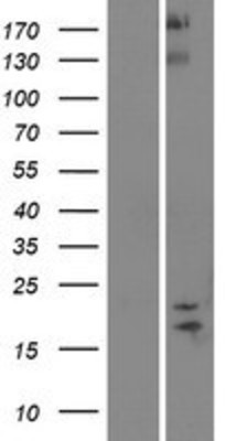 Western Blot: SPAG11B Overexpression Lysate (Adult Normal) [NBP2-05795] Left-Empty vector transfected control cell lysate (HEK293 cell lysate); Right -Over-expression Lysate for SPAG11B.