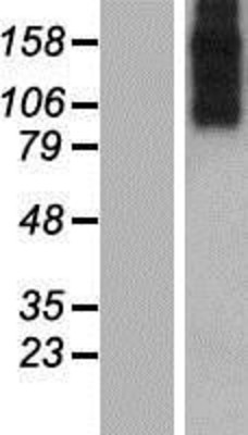 Western Blot: Sodium-Calcium Exchanger Overexpression Lysate (Adult Normal) [NBP2-05794] Left-Empty vector transfected control cell lysate (HEK293 cell lysate); Right -Over-expression Lysate for Sodium-Calcium Exchanger.