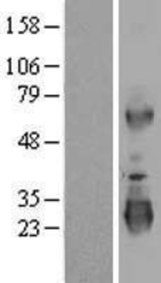 Western Blot: LRRC3 Overexpression Lysate (Adult Normal) [NBP2-06173] Left-Empty vector transfected control cell lysate (HEK293 cell lysate); Right -Over-expression Lysate for LRRC3.