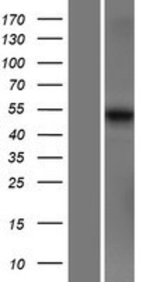 Western Blot: MARCO Overexpression Lysate (Adult Normal) [NBP2-07582] Left-Empty vector transfected control cell lysate (HEK293 cell lysate); Right -Over-expression Lysate for MARCO.