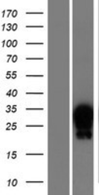Western Blot: HOXA7 Overexpression Lysate (Adult Normal) [NBP2-07564] Left-Empty vector transfected control cell lysate (HEK293 cell lysate); Right -Over-expression Lysate for HOXA7.