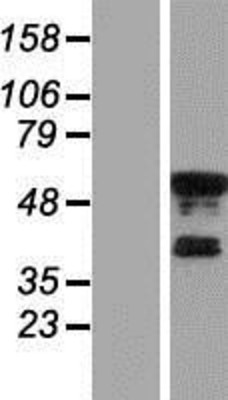 Western Blot: KLF8 Overexpression Lysate (Adult Normal) [NBP2-07514] Left-Empty vector transfected control cell lysate (HEK293 cell lysate); Right -Over-expression Lysate for KLF8.