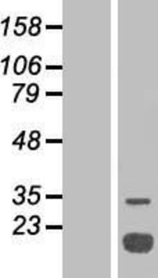 Western Blot: ACP1 Overexpression Lysate (Adult Normal) [NBP2-07886] Left-Empty vector transfected control cell lysate (HEK293 cell lysate); Right -Over-expression Lysate for ACP1.