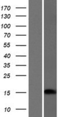 Western Blot: CRABP1 Overexpression Lysate (Adult Normal) [NBP2-07877] Left-Empty vector transfected control cell lysate (HEK293 cell lysate); Right -Over-expression Lysate for CRABP1.