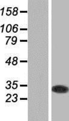 Western Blot: GSTO1 Overexpression Lysate (Adult Normal) [NBP2-07819] Left-Empty vector transfected control cell lysate (HEK293 cell lysate); Right -Over-expression Lysate for GSTO1.