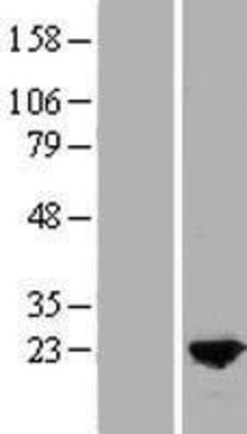Western Blot: MYL9 Overexpression Lysate (Adult Normal) [NBP2-07665] Left-Empty vector transfected control cell lysate (HEK293 cell lysate); Right -Over-expression Lysate for MYL9.