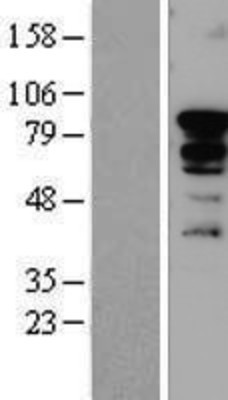 Western Blot: SORBS2 Overexpression Lysate (Adult Normal) [NBP2-07976] Left-Empty vector transfected control cell lysate (HEK293 cell lysate); Right -Over-expression Lysate for SORBS2.