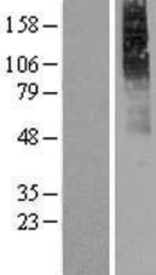 Western Blot: Muscarinic Acetylcholine Receptor 2 Overexpression Lysate (Adult Normal) [NBP2-08825] Left-Empty vector transfected control cell lysate (HEK293 cell lysate); Right -Over-expression Lysate for Muscarinic Acetylcholine Receptor 2.