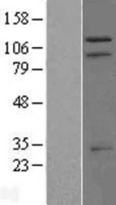 Western Blot: TRIM37 Overexpression Lysate (Adult Normal) [NBP2-08877] Left-Empty vector transfected control cell lysate (HEK293 cell lysate); Right -Over-expression Lysate for TRIM37.