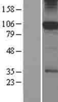 Western Blot: SFMBT1 Overexpression Lysate (Adult Normal) [NBP2-08909] Left-Empty vector transfected control cell lysate (HEK293 cell lysate); Right -Over-expression Lysate for SFMBT1.