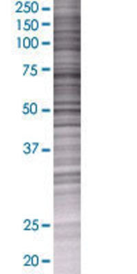 CRH transfected lysate.