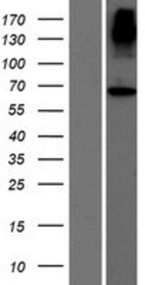 Western Blot: ACCSL Overexpression Lysate (Adult Normal) [NBP2-08596] Left-Empty vector transfected control cell lysate (HEK293 cell lysate); Right -Over-expression Lysate for ACCSL.