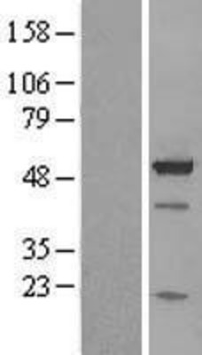 Western Blot: BAG5 Overexpression Lysate (Adult Normal) [NBP2-08749] Left-Empty vector transfected control cell lysate (HEK293 cell lysate); Right -Over-expression Lysate for BAG5.