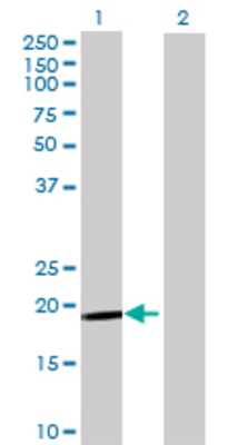 Lane 1: CRH transfected lysate (21.67 KDa) Lane 2: Non-transfected lysate.
