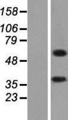 Western Blot: ALAS2 Overexpression Lysate (Adult Normal) [NBP2-08559] Left-Empty vector transfected control cell lysate (HEK293 cell lysate); Right -Over-expression Lysate for ALAS2.
