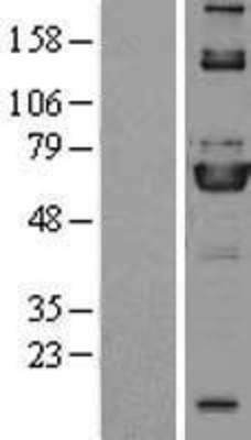Western Blot: ME3 Overexpression Lysate (Adult Normal) [NBP2-08745] Left-Empty vector transfected control cell lysate (HEK293 cell lysate); Right -Over-expression Lysate for ME3.
