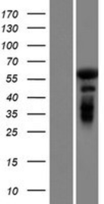 Western Blot: GAB4 Overexpression Lysate (Adult Normal) [NBP2-08558] Left-Empty vector transfected control cell lysate (HEK293 cell lysate); Right -Over-expression Lysate for GAB4.