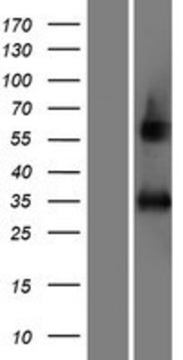 Western Blot: AFMID Overexpression Lysate (Adult Normal) [NBP2-08777] Left-Empty vector transfected control cell lysate (HEK293 cell lysate); Right -Over-expression Lysate for AFMID.